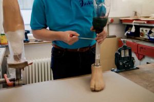 Prothese - Orthopädie Jäckle